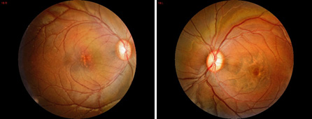 eye01.jpg eye01.jpg