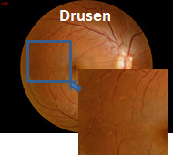 eye02.jpg eye02.jpg