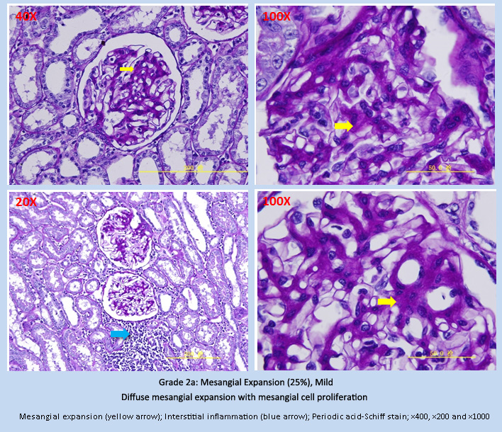 CKD-5.jpg CKD-5.jpg