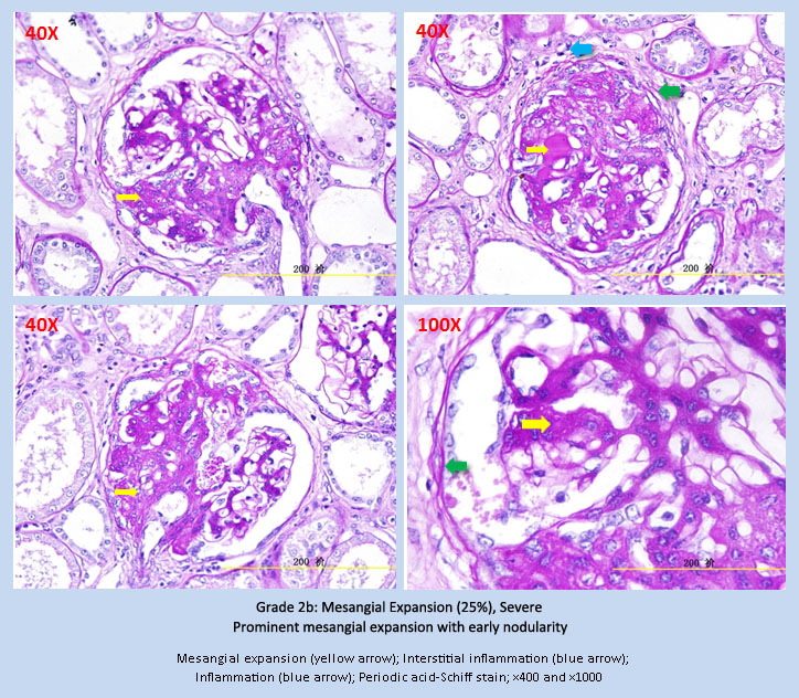 CKD-6.jpg CKD-6.jpg