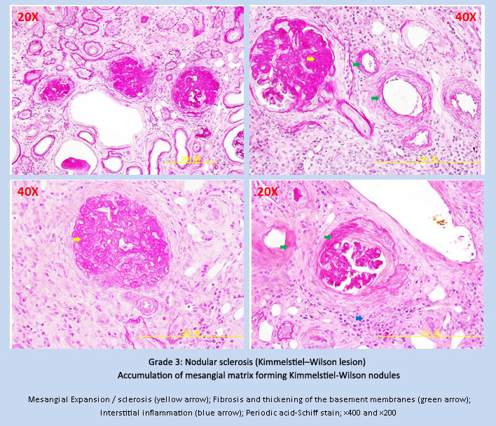 CKD-7.jpg CKD-7.jpg