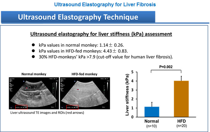 Ultrasound 1.jpg Ultrasound 1.jpg