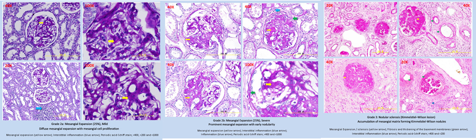 ckd 02.jpg ckd 02.jpg