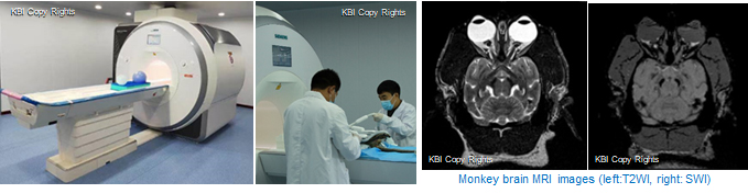 imaging MRI.jpg imaging MRI.jpg