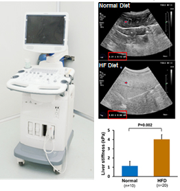 ultrasound 1.jpg