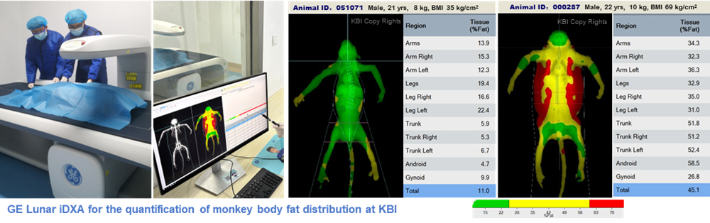 obese 01.jpg