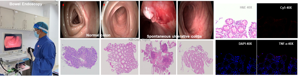 IBD-01.jpg