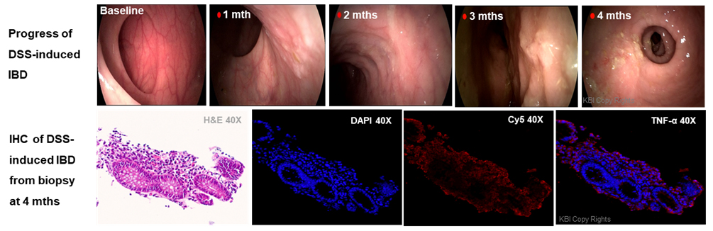 IBD 02.jpg