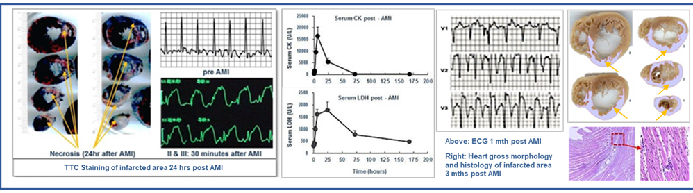 心肌梗死 01.jpg