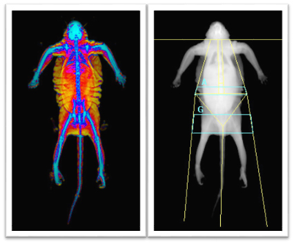 Obesity and Metabolic Syndrome